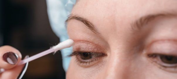 Zalecenia po korekcie powiek górnych